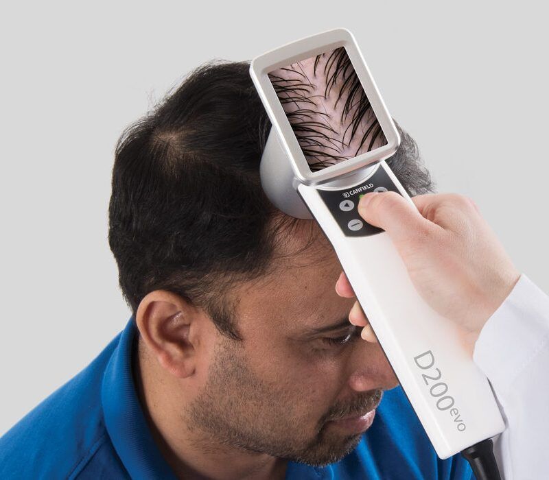 hair analysis Hair Analysis